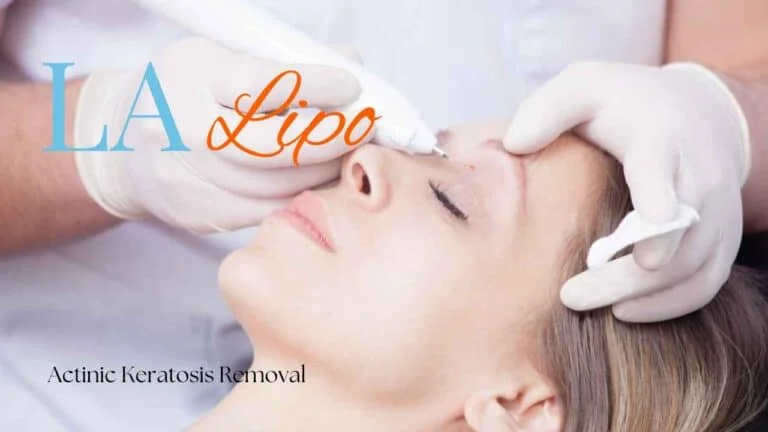 Woman receiving Actinic Keratosis Removal Treatment Stonebridge