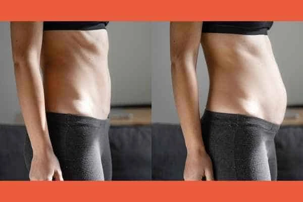 LA-EMS Body Sculpting results Stonebridge