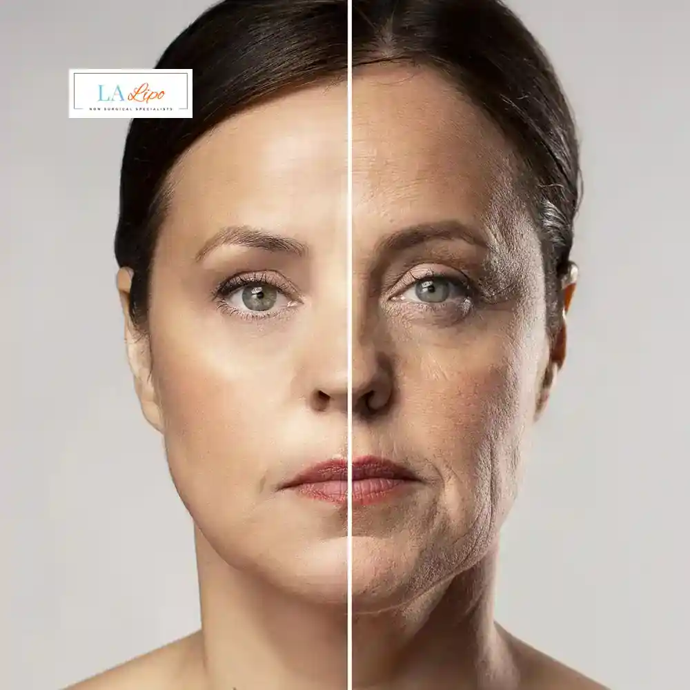 How Can You Tell If Non-Surgical Skin Tightening Is Right for You Stonebridge?