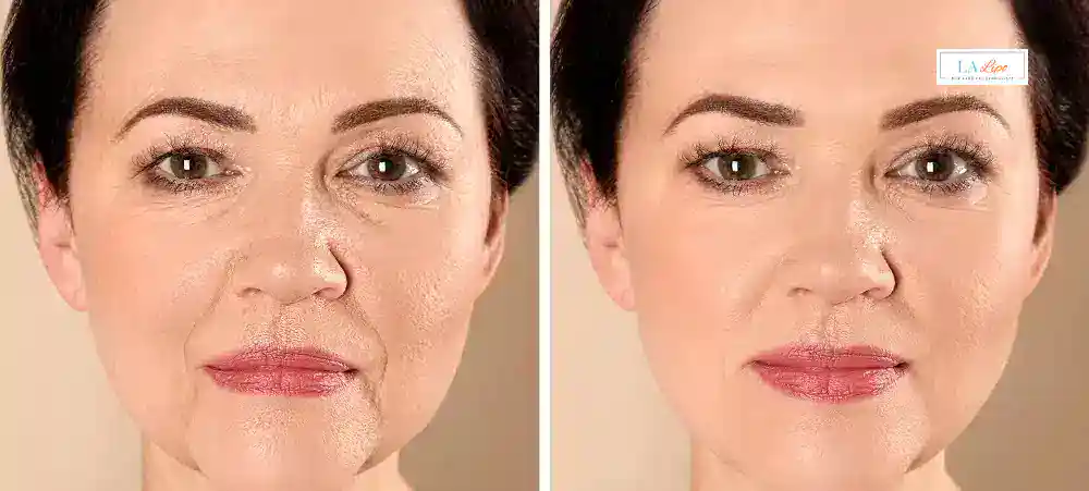 Why Aren’t My Skincare Products Making My Sagging Skin Look Firmer Stonebridge?
