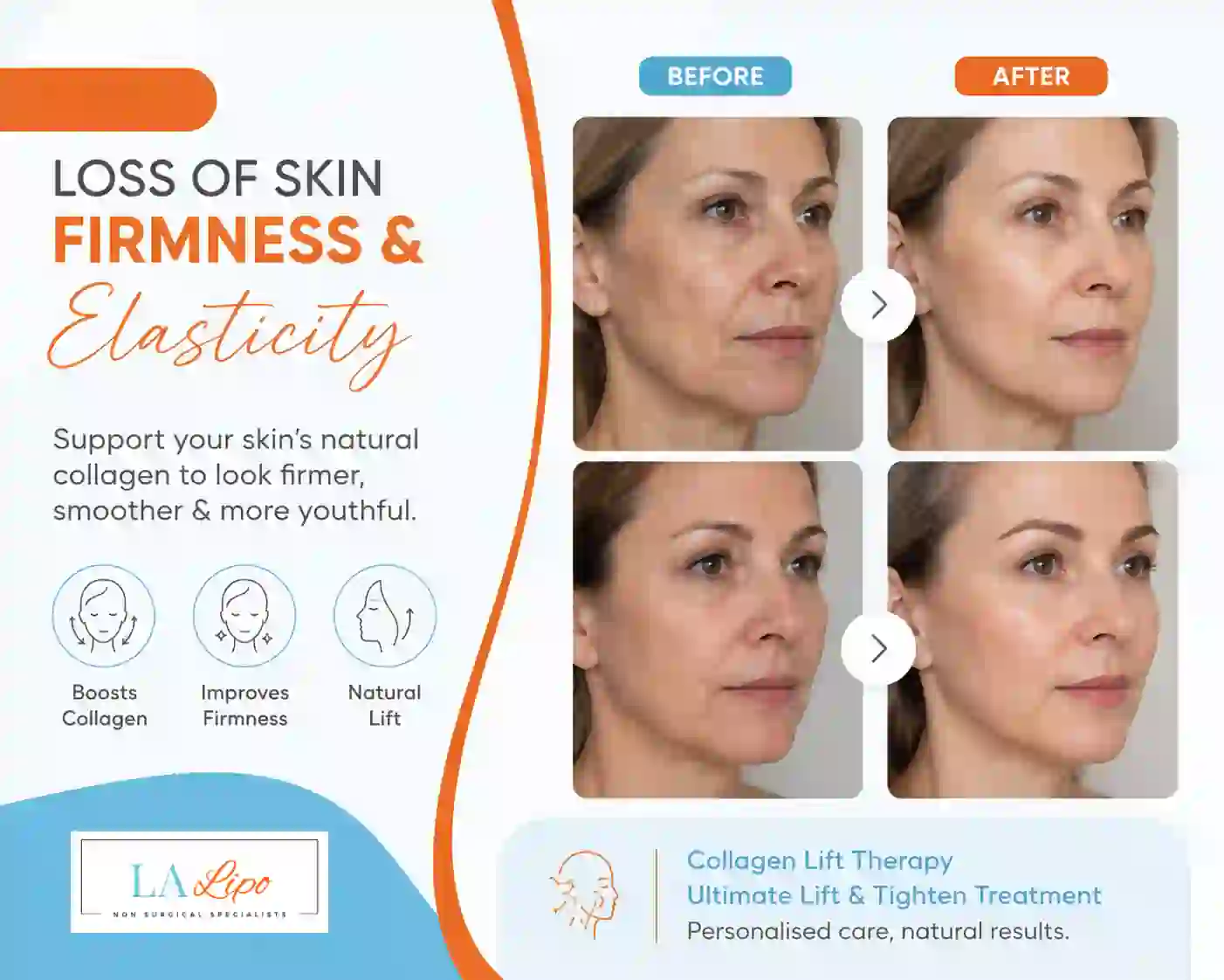 Sign #7: Loss of Skin Firmness and Elasticity Stonebridge