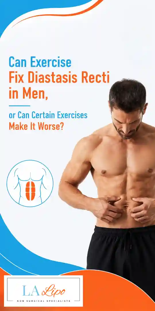 Can Exercise Fix Diastasis Recti in Men, or Can Certain Exercises Make It Worse Stonebridge?